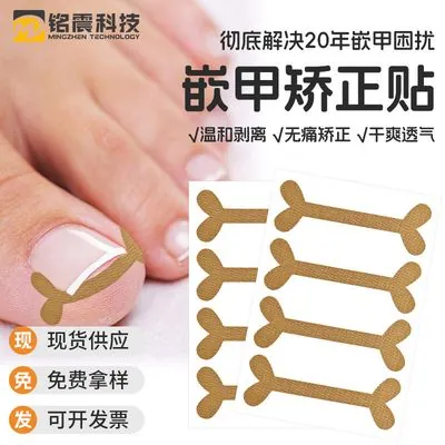 Y-Shape Nail Correction Patch (Glue-Free)